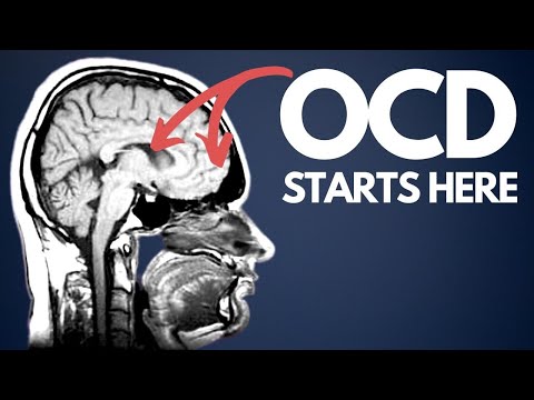Ocd Explained For Beginners - How I Wish I Was Taught